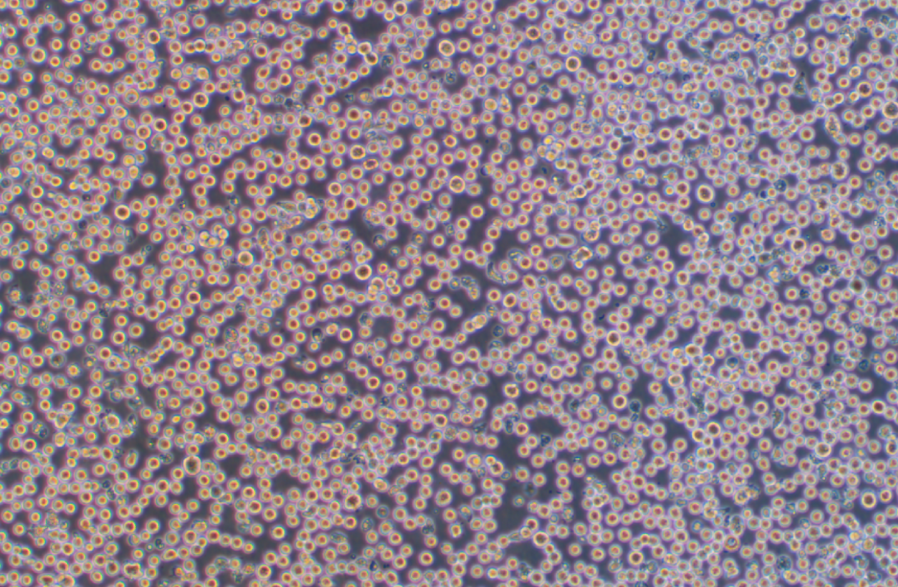 人成巨核細胞白血病細胞MEG-01(STR鑒定正確)