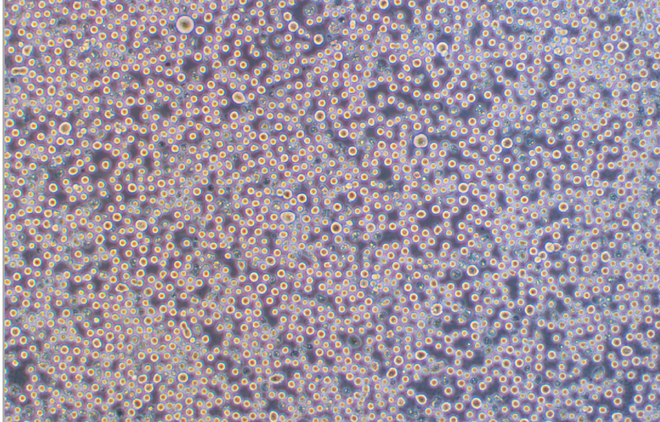 人成巨核細胞白血病細胞MEG-01(STR鑒定正確)