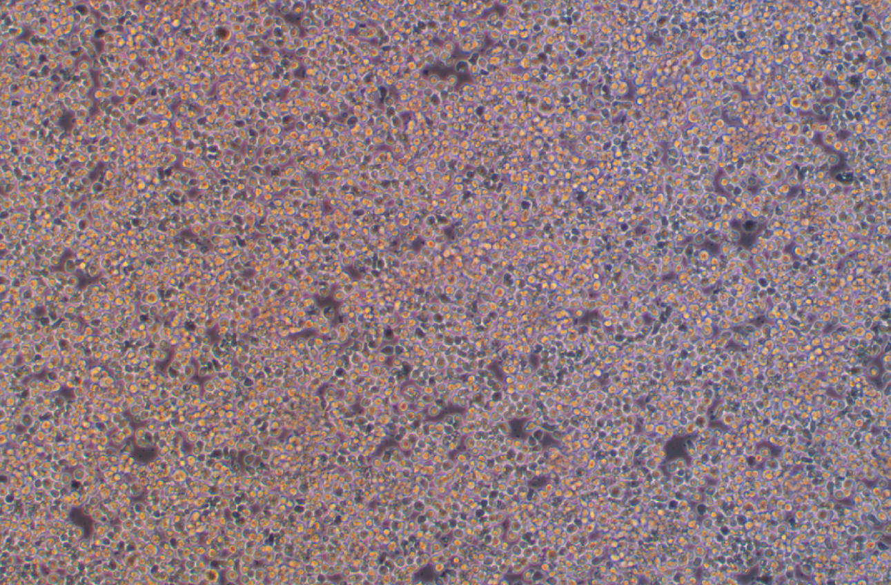 小鼠急性骨髓性白血病C1498(種屬鑒定)