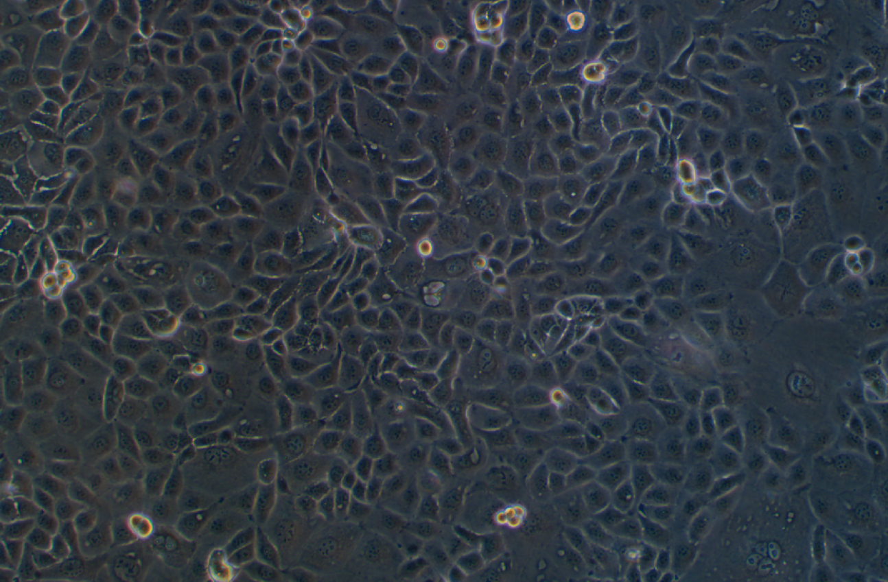 人卵巢癌腺癌細(xì)胞NIH:OVCAR-3(STR鑒定正確)