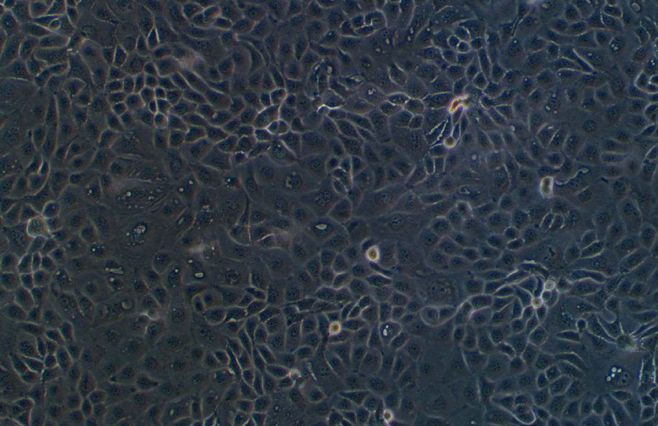 人卵巢癌腺癌細(xì)胞NIH:OVCAR-3(STR鑒定正確)