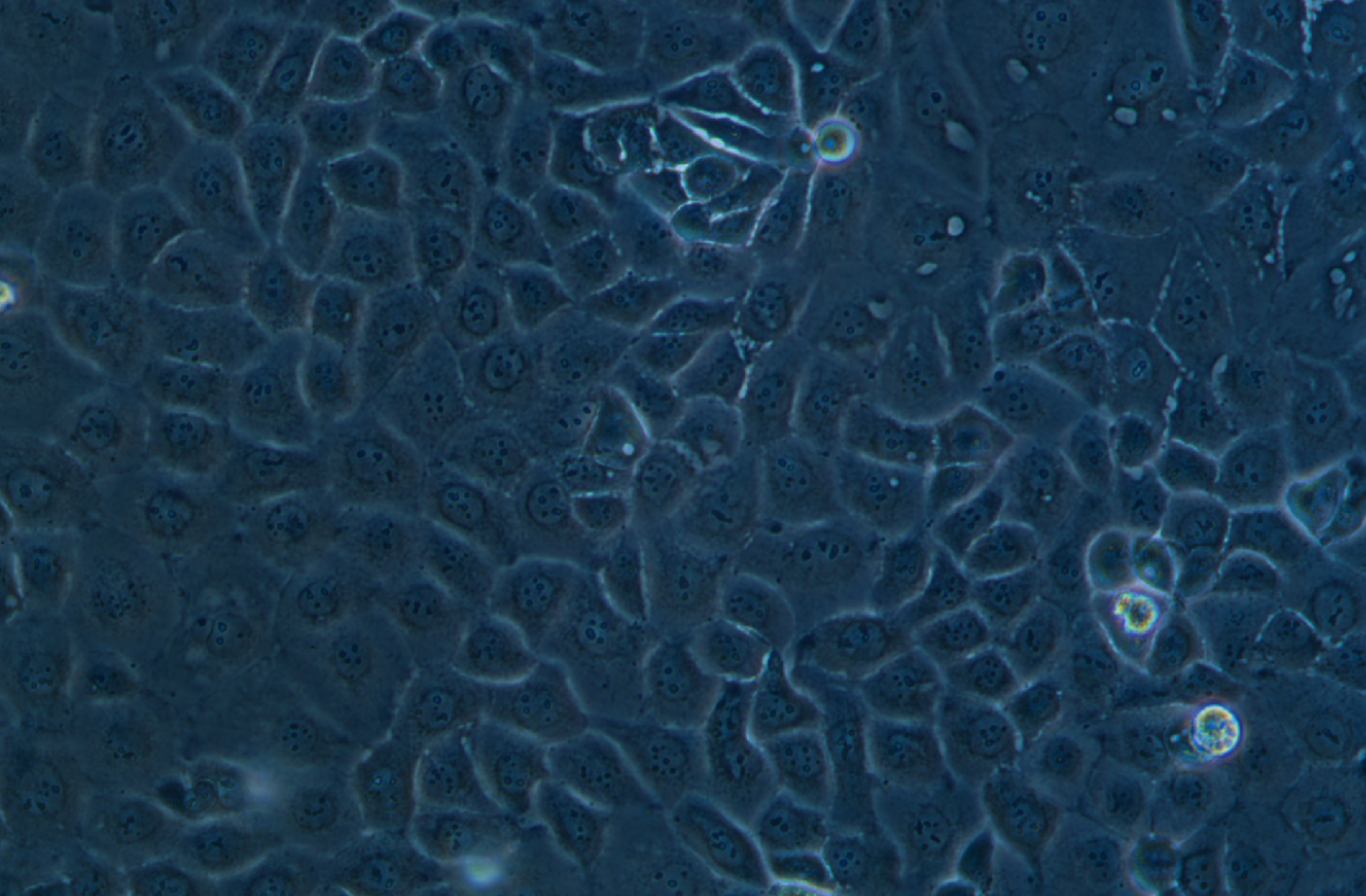 人卵巢癌腺癌細(xì)胞NIH:OVCAR-3(STR鑒定正確)