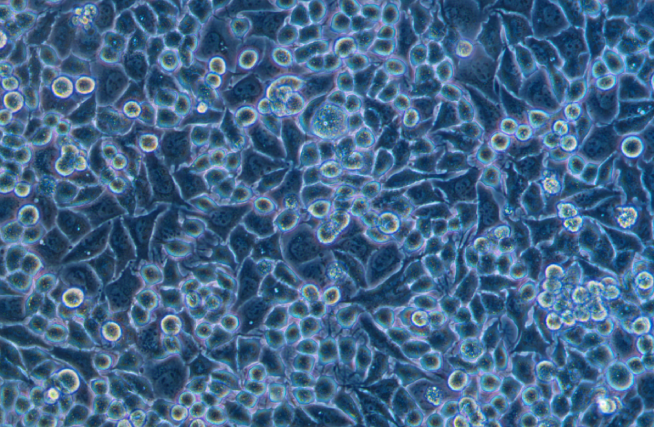 人胰腺癌細胞KP4(STR鑒定正確)