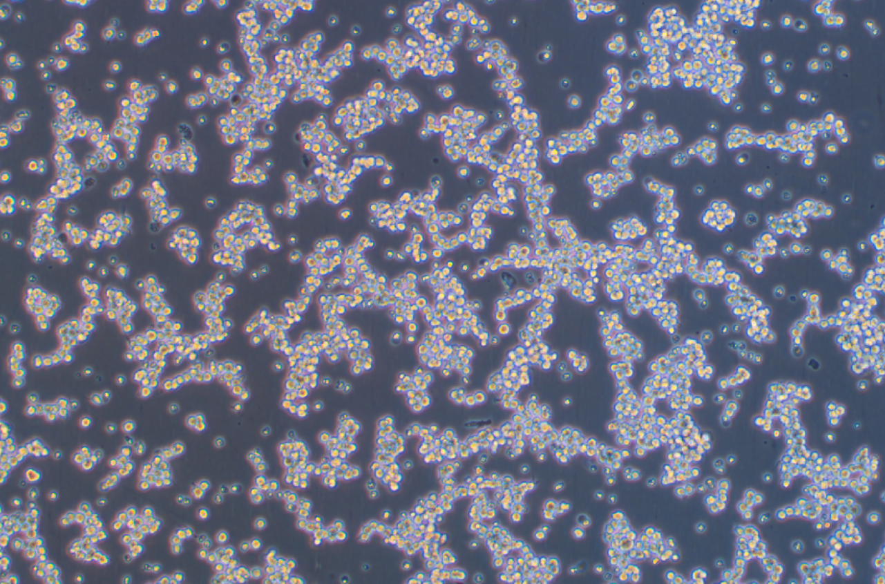 人彌漫大B淋巴瘤細胞OCI-LY10? (STR鑒定正確)