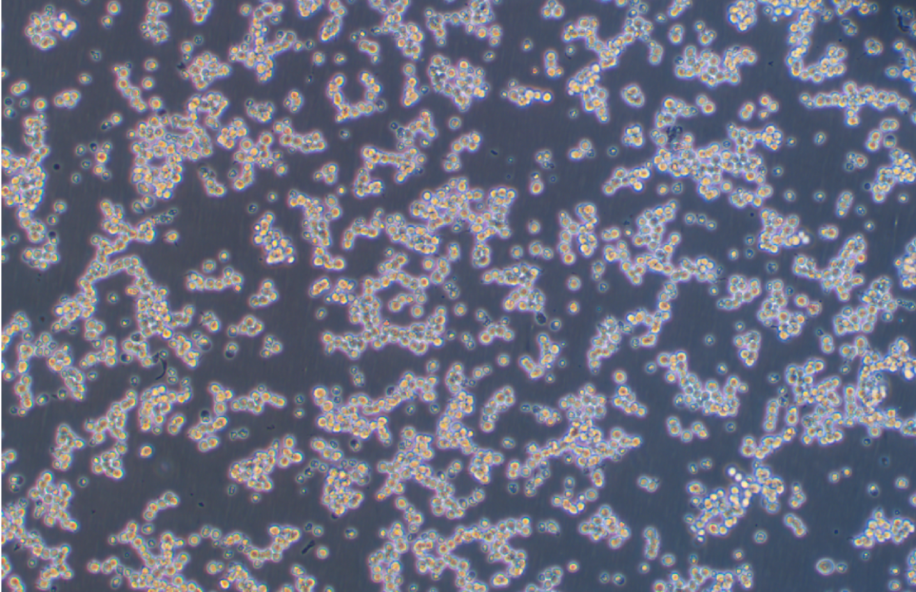 人彌漫大B淋巴瘤細胞OCI-LY10? (STR鑒定正確)