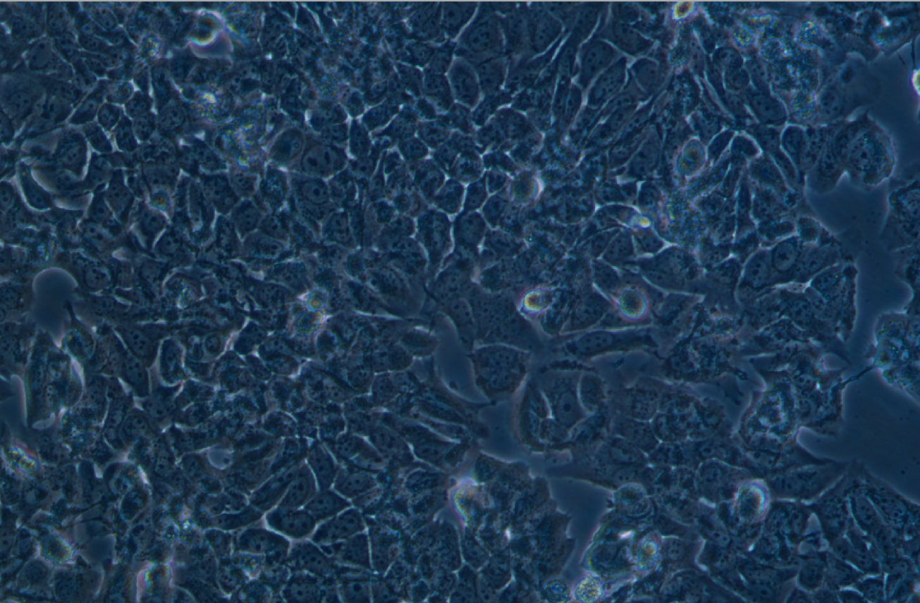 人乳腺癌阿霉素耐藥細胞株MCF-7+adr (STR鑒定正確)