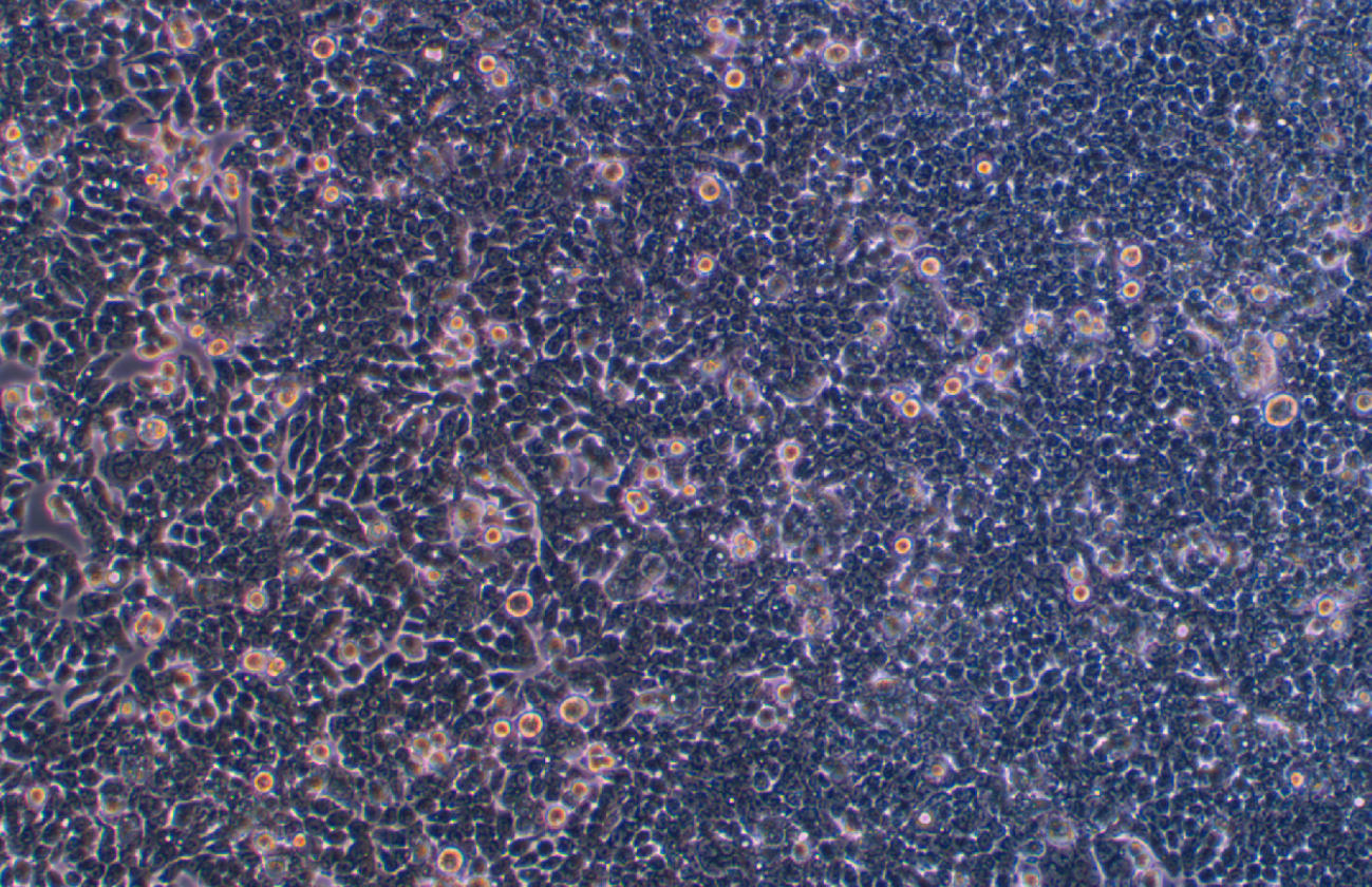 人大腸癌細胞CX-1(STR鑒定正確)