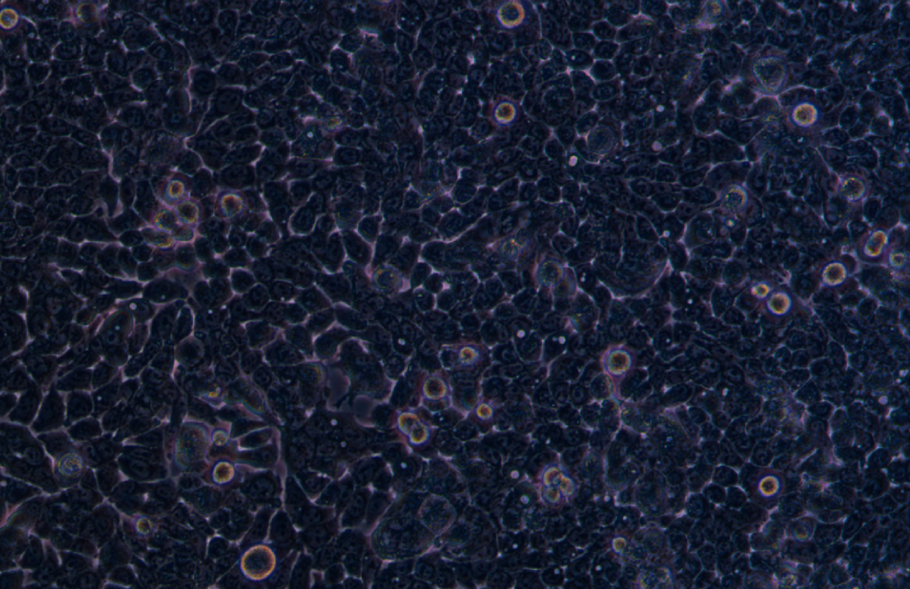 人大腸癌細胞CX-1(STR鑒定正確)