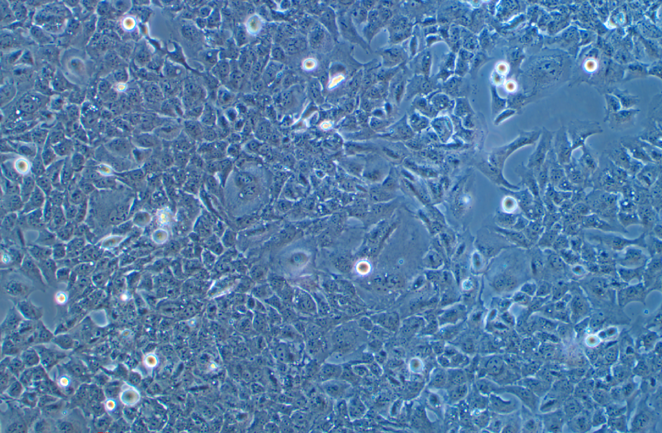 人小膠質細胞HMC3(STR鑒定正確)
