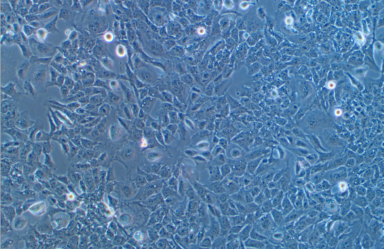 人小膠質細胞HMC3(STR鑒定正確)
