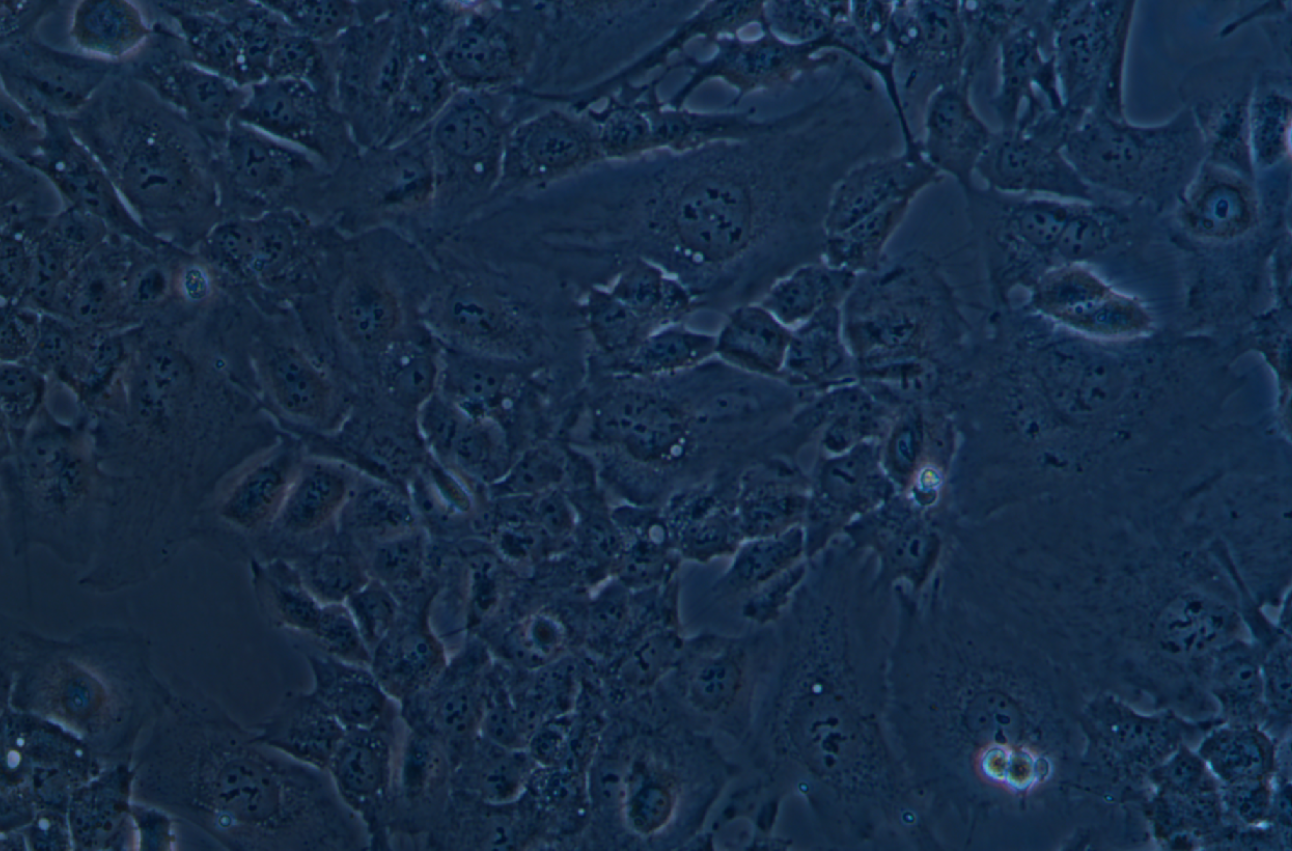 人小膠質細胞HMC3(STR鑒定正確)