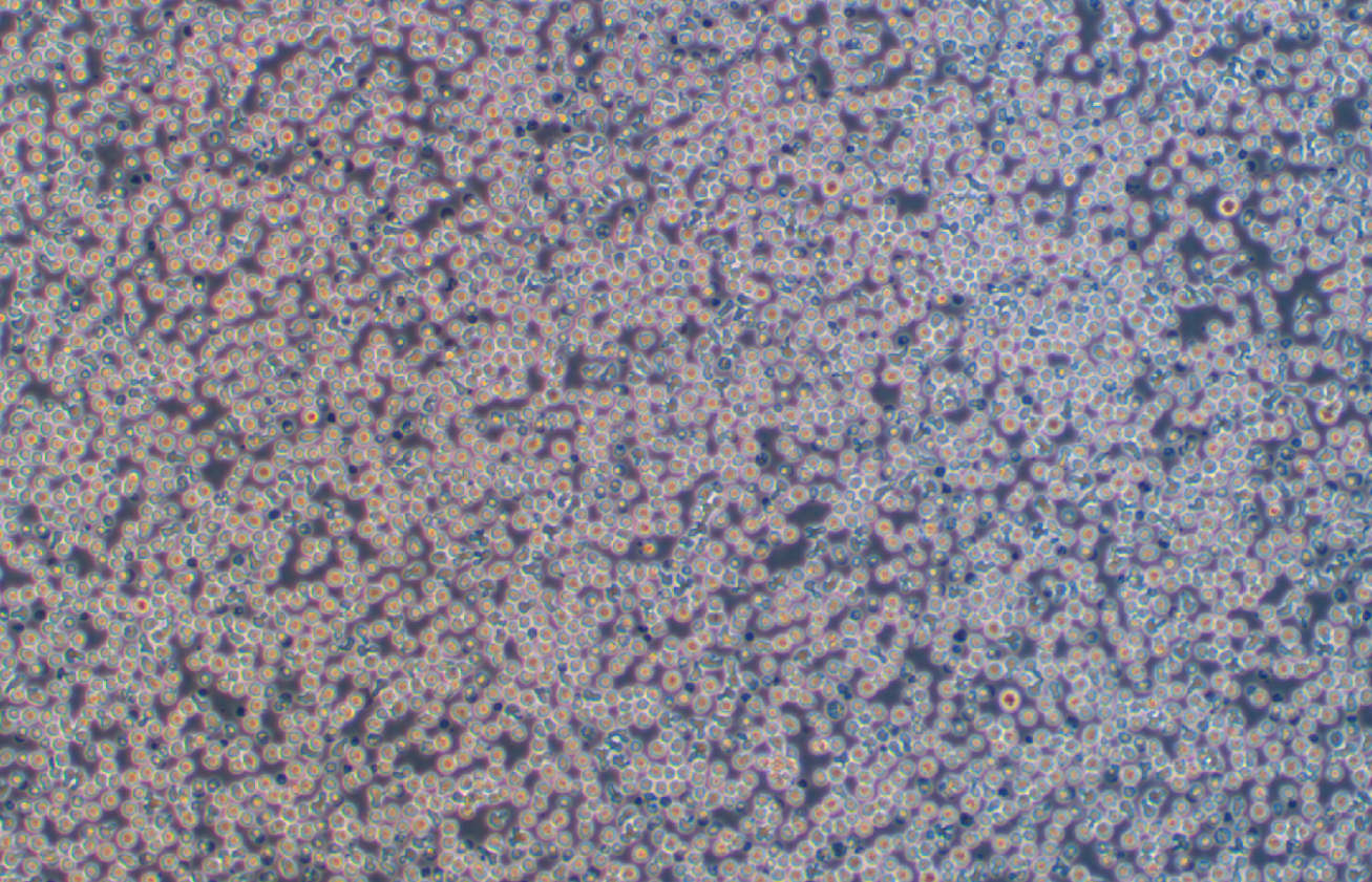 人B淋巴細胞瘤細胞RAMOS(STR鑒定正確)