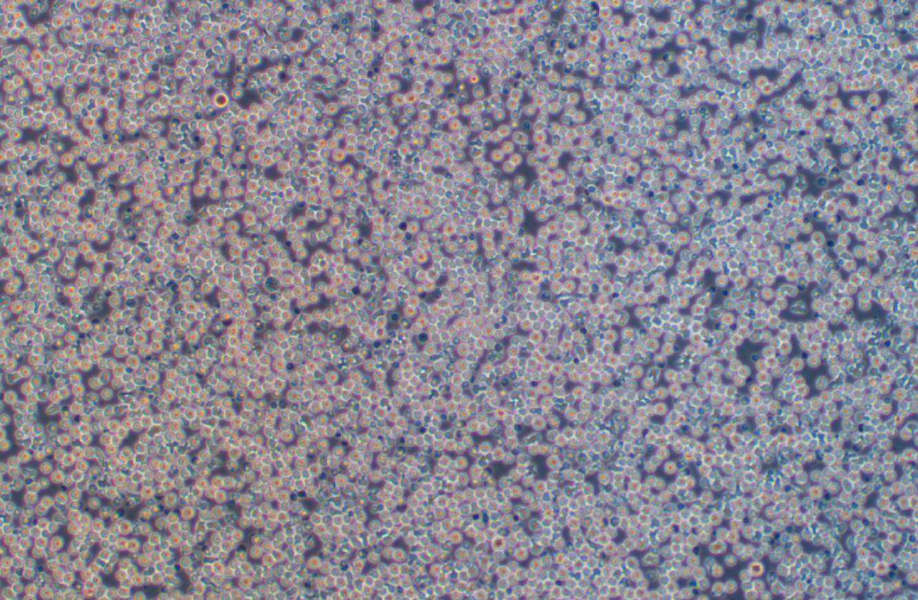 人B淋巴細胞瘤細胞RAMOS(STR鑒定正確)