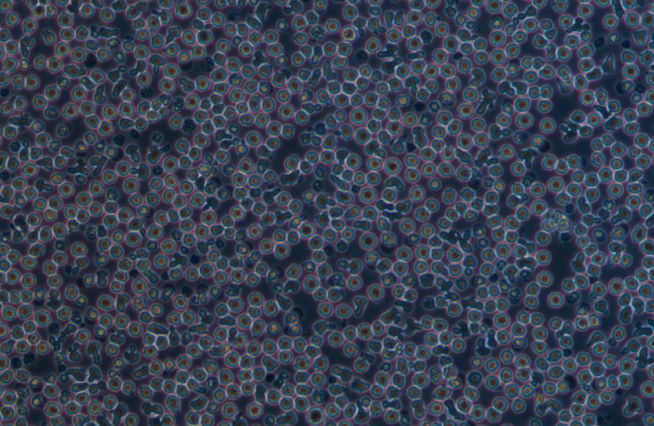 人B淋巴細胞瘤細胞RAMOS(STR鑒定正確)