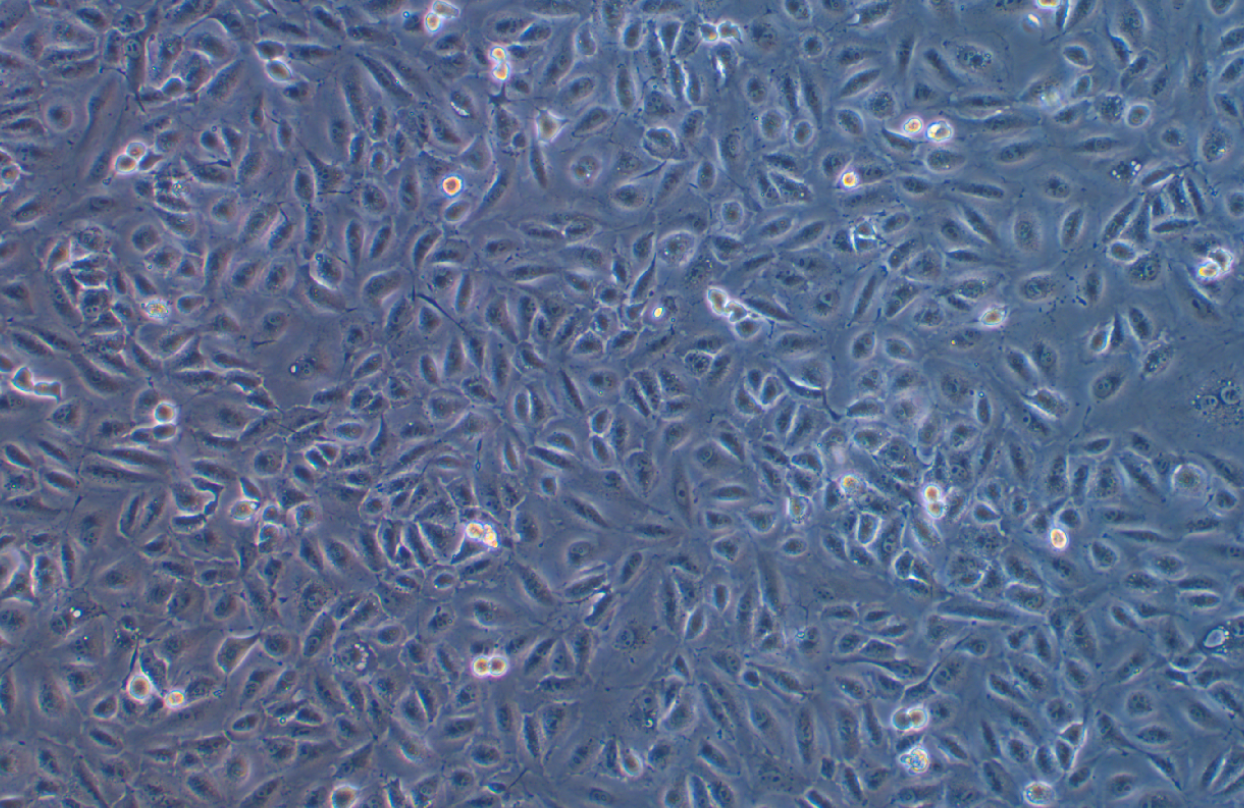 人卵巢癌順鉑耐藥株SKOV3/DDP(STR鑒定正確)