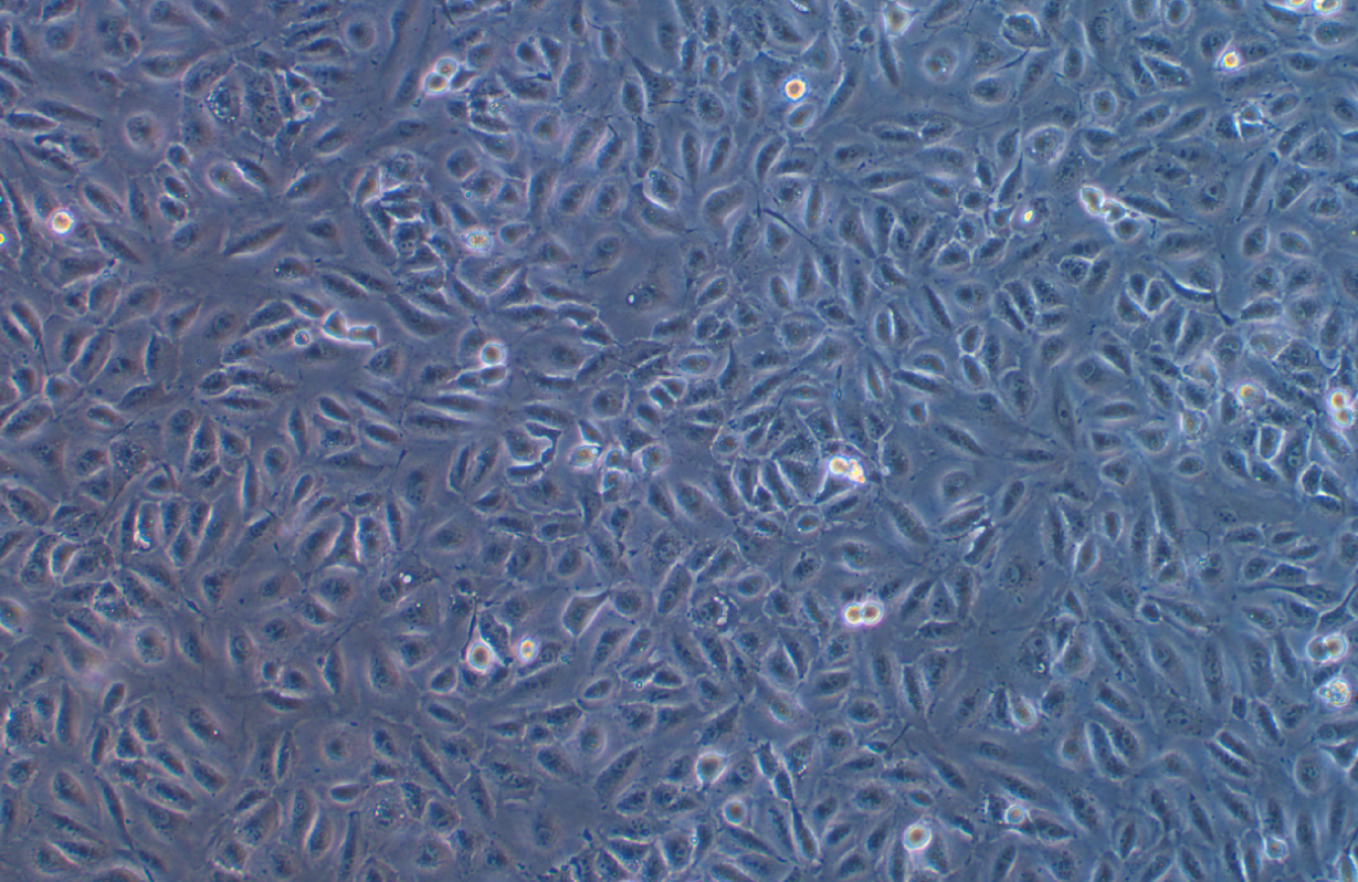 人卵巢癌順鉑耐藥株SKOV3/DDP(STR鑒定正確)