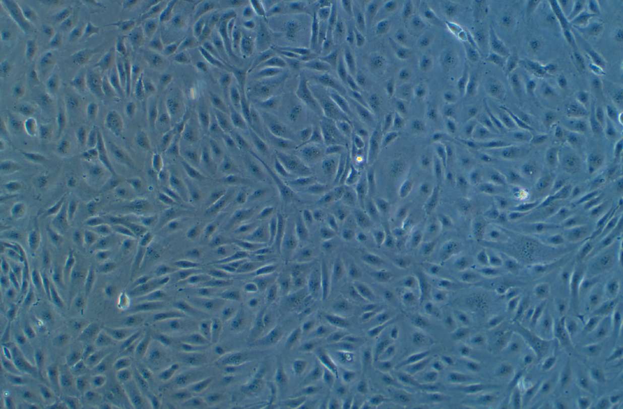 人臍靜脈內皮細胞永生化HUVEC(免疫熒光鑒定)