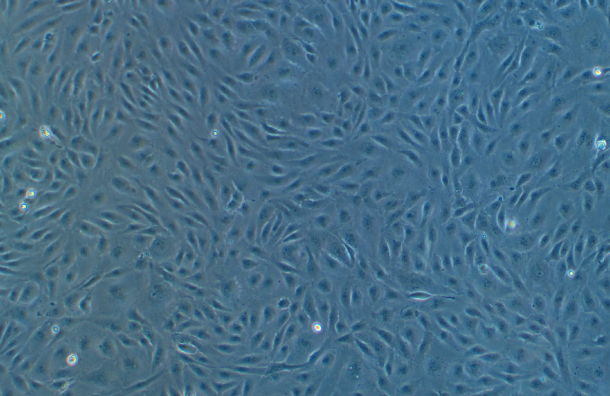 人臍靜脈內皮細胞永生化HUVEC(免疫熒光鑒定)