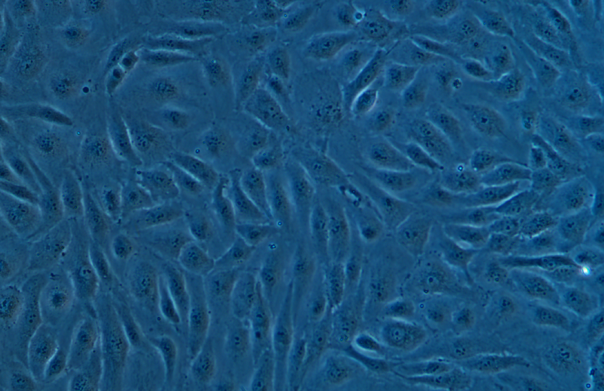 人臍靜脈內皮細胞永生化HUVEC(免疫熒光鑒定)