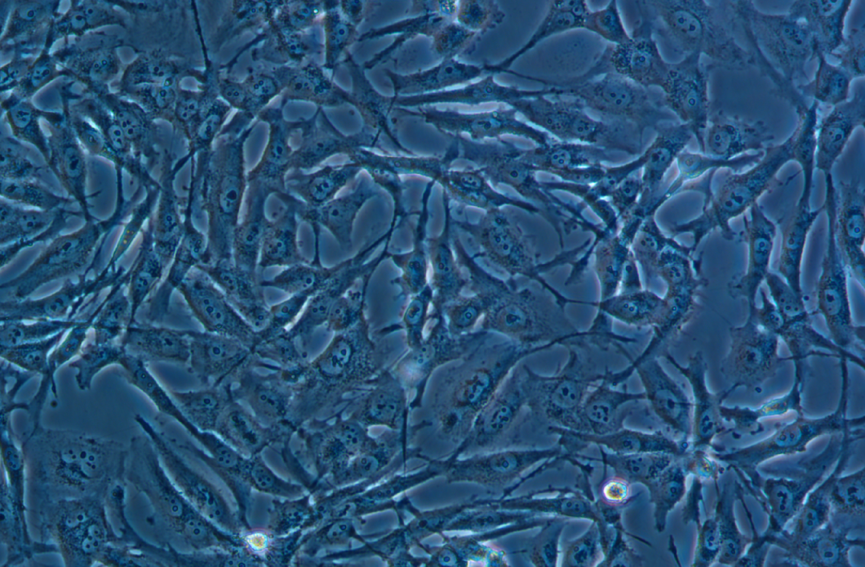 人神經膠質細胞瘤細胞U251 (STR鑒定正確)