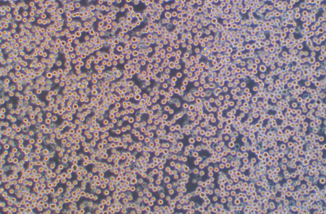 EB病毒感染的人外周淋巴細胞JVM-2(STR鑒定正確)