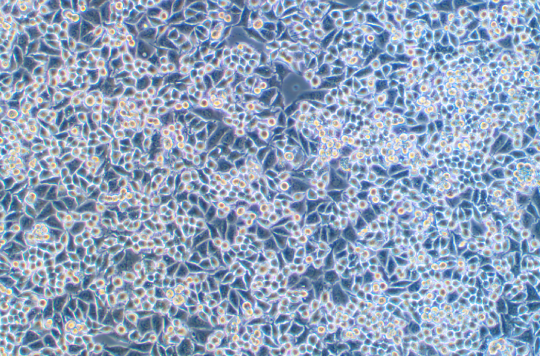 人乳腺癌細(xì)胞KPL-4(STR鑒定正確)