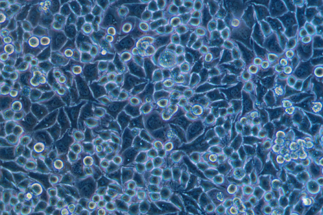 人乳腺癌細(xì)胞KPL-4(STR鑒定正確)