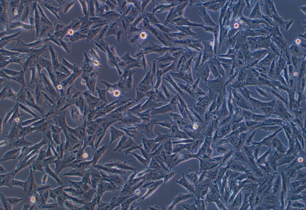 人黑色素瘤細胞A2058(STR鑒定正確)