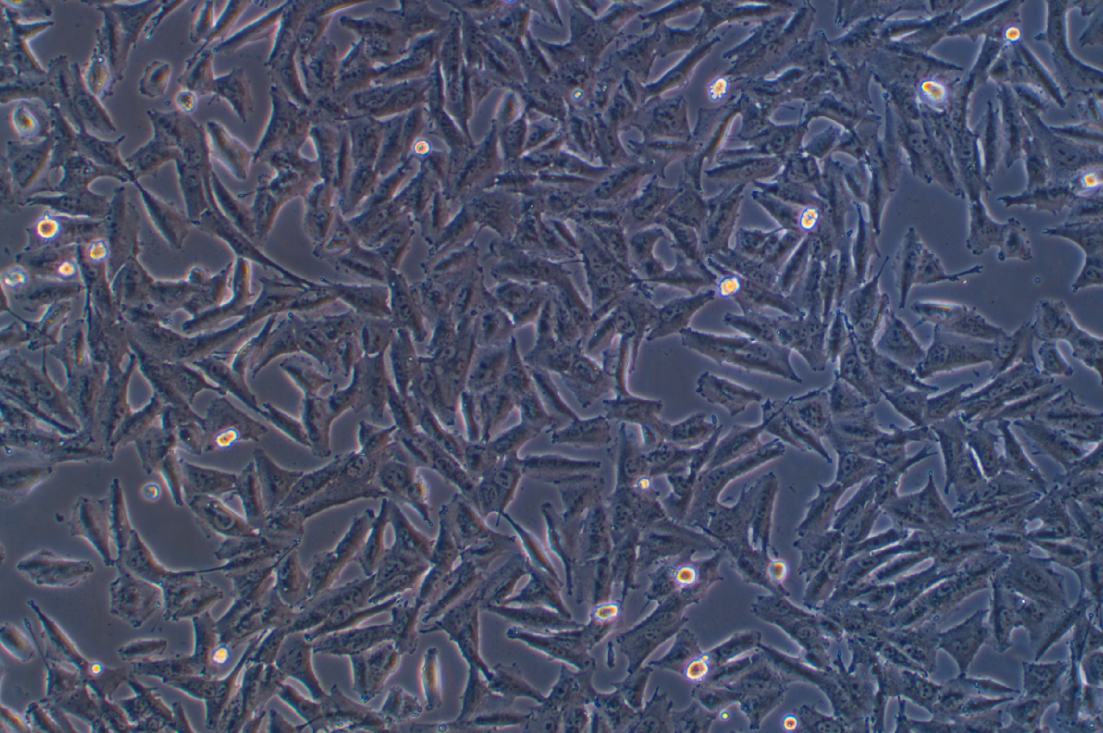 人黑色素瘤細胞A2058(STR鑒定正確)