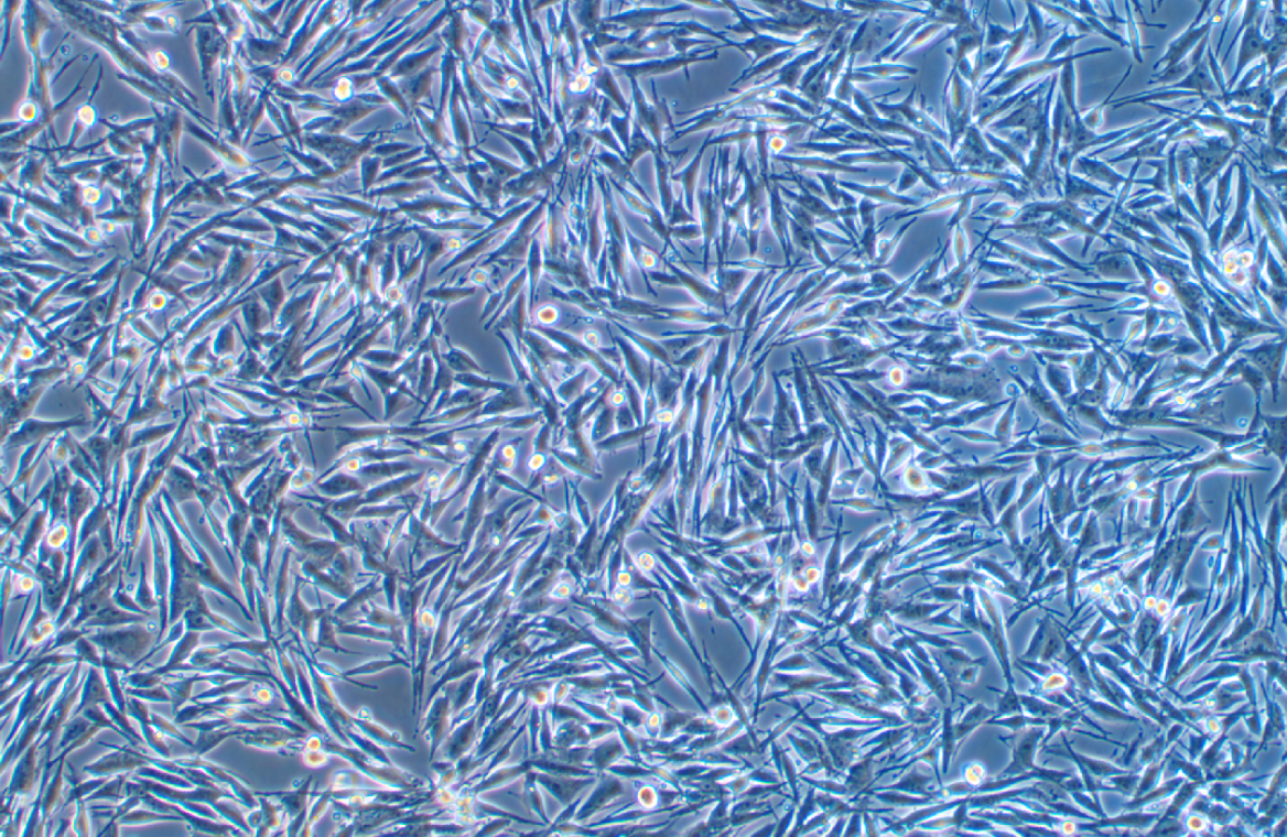 人惡性黑色素瘤細胞MeWo(STR鑒定正確)