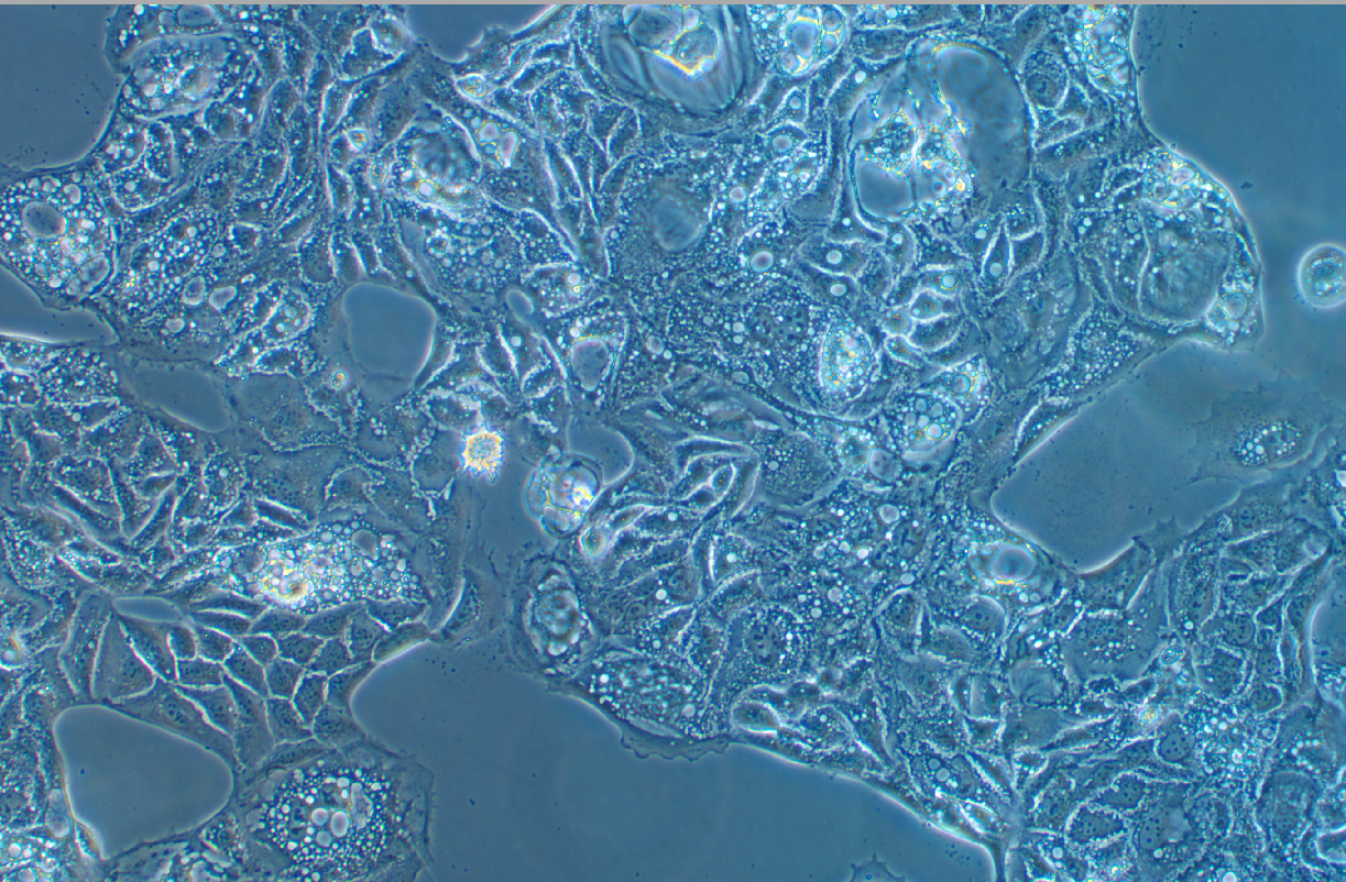 人卵巢癌細(xì)胞Caov-4(STR鑒定正確)