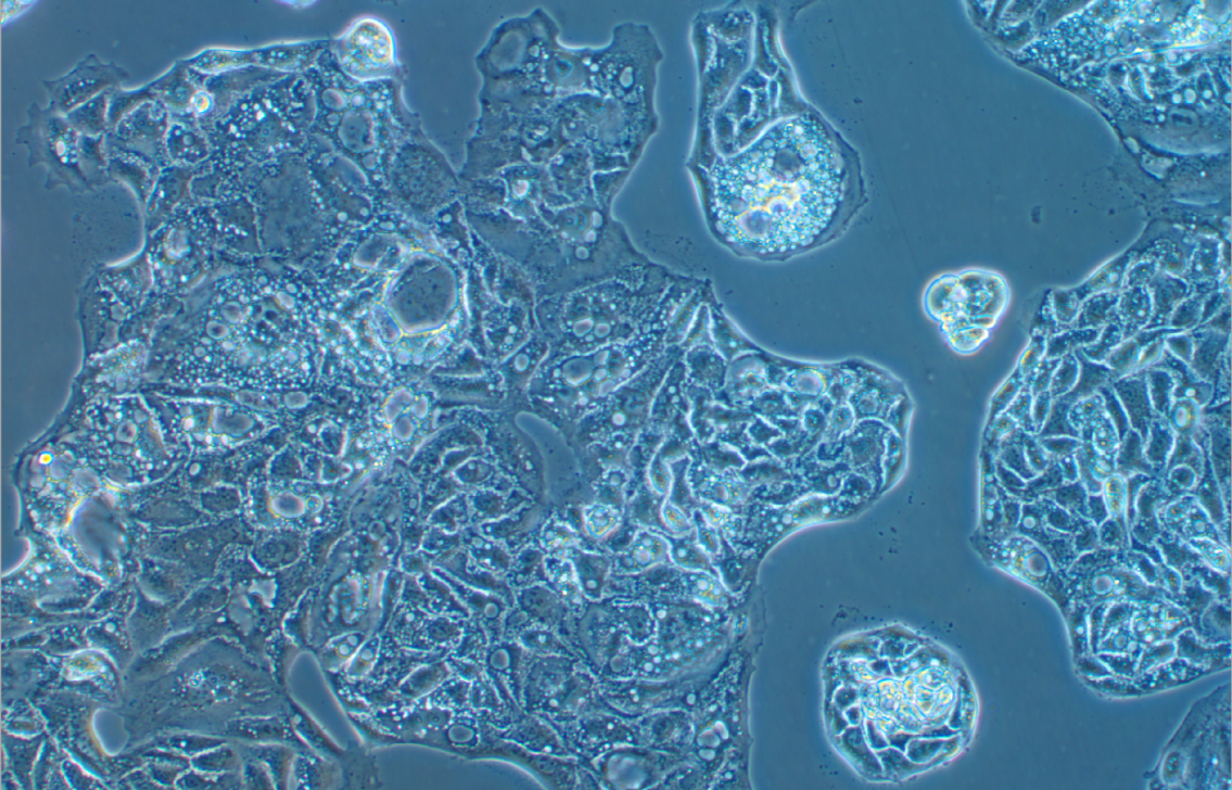 人卵巢癌細(xì)胞Caov-4(STR鑒定正確)