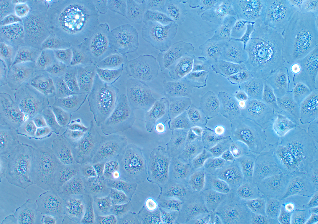 人胃癌細(xì)胞FU97(STR鑒定正確)