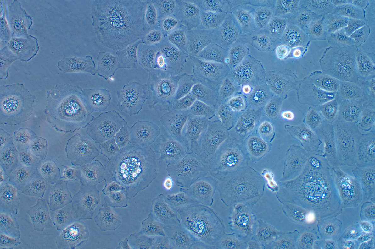 人胃癌細(xì)胞FU97(STR鑒定正確)