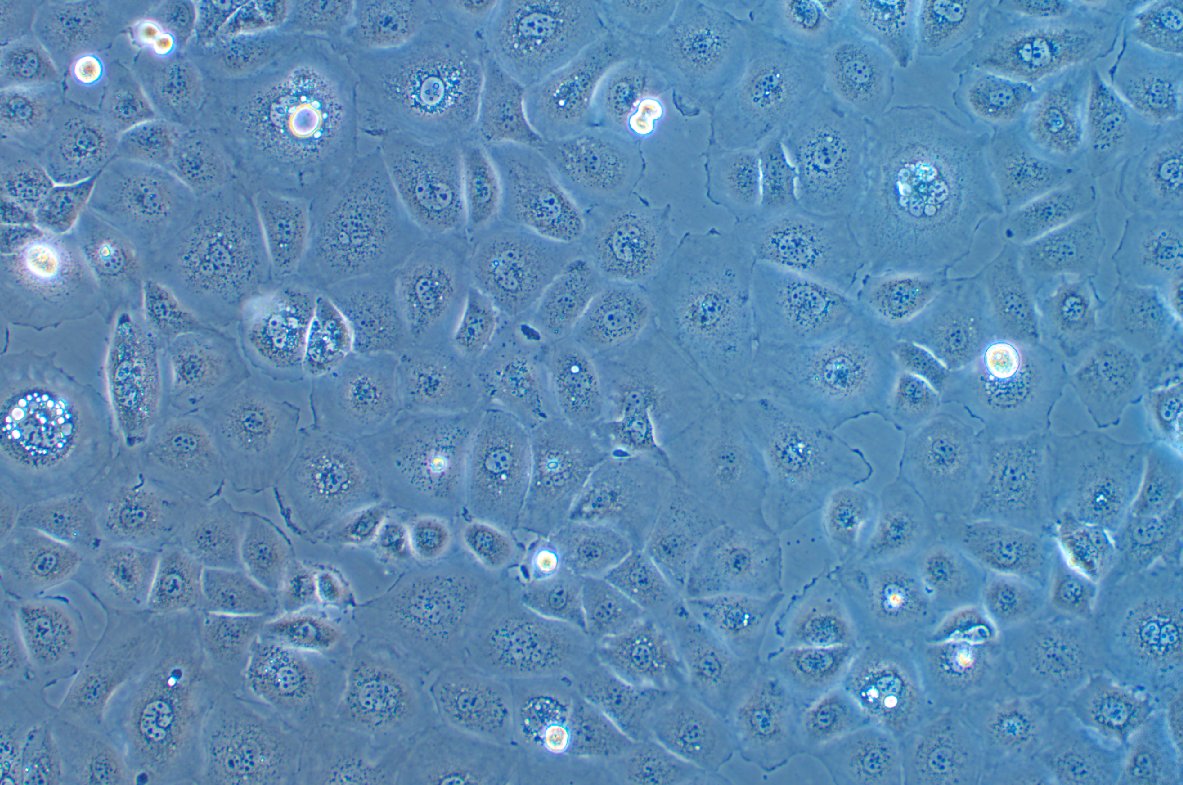 人胃癌細(xì)胞FU97(STR鑒定正確)