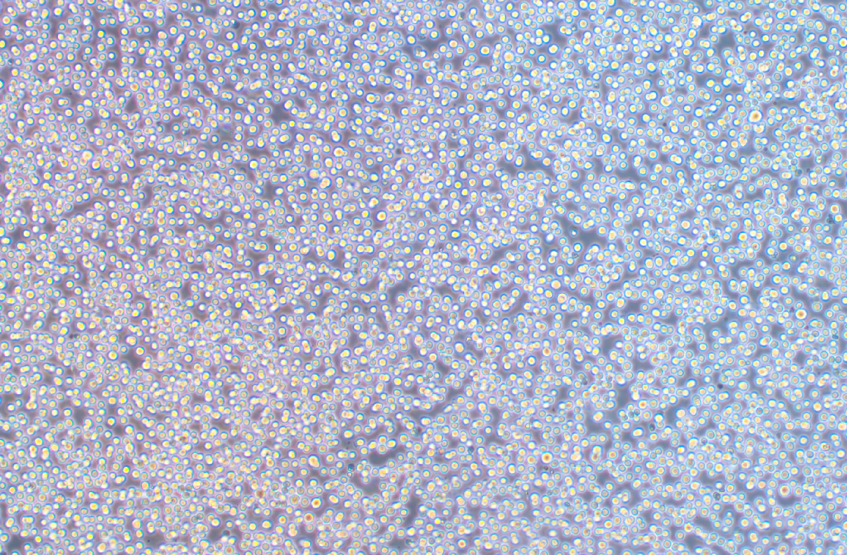 人套細胞淋巴瘤細胞REC-1 (STR鑒定正確)