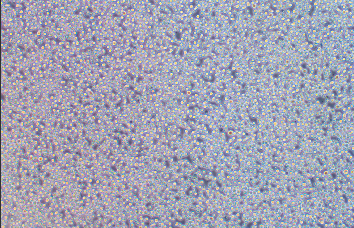 人套細胞淋巴瘤細胞REC-1 (STR鑒定正確)