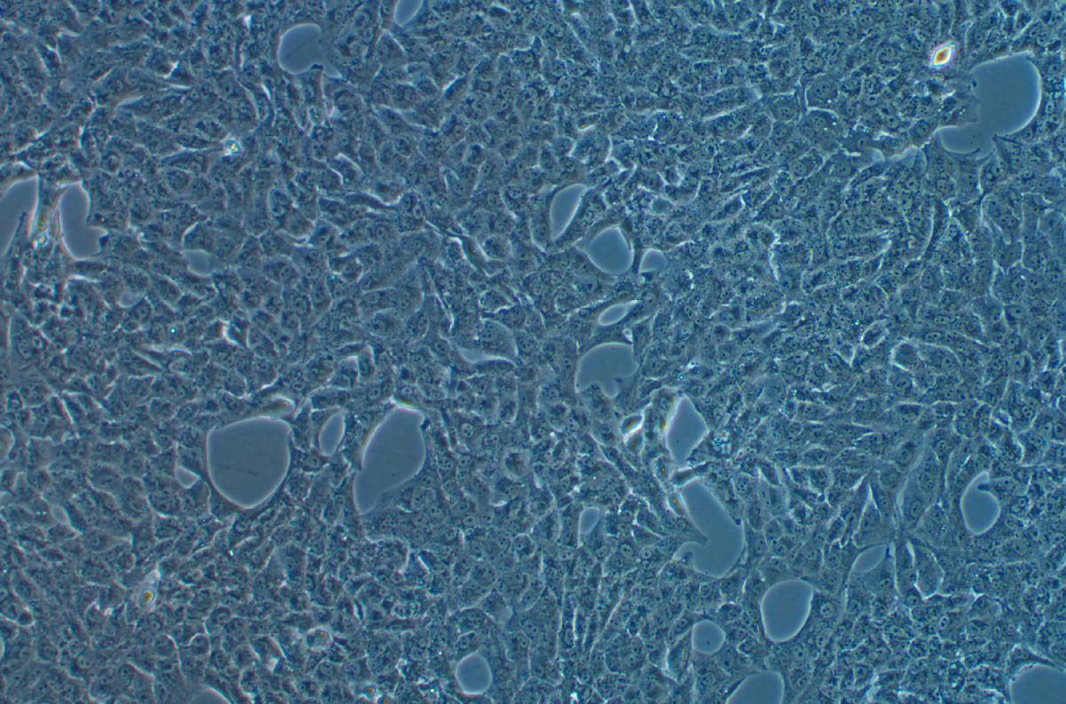人腎癌細胞SN12C(STR鑒定正確)