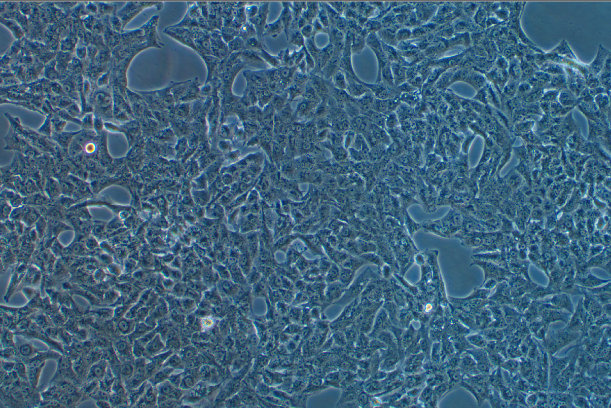 人腎癌細胞SN12C(STR鑒定正確)
