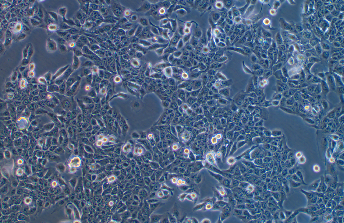 人乳腺癌細胞JIMT-1(STR鑒定正確)