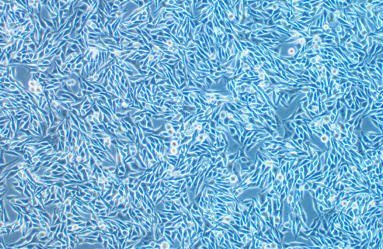 人脈絡(luò)膜黑色素瘤細(xì)胞MEL270(STR鑒定正確)
