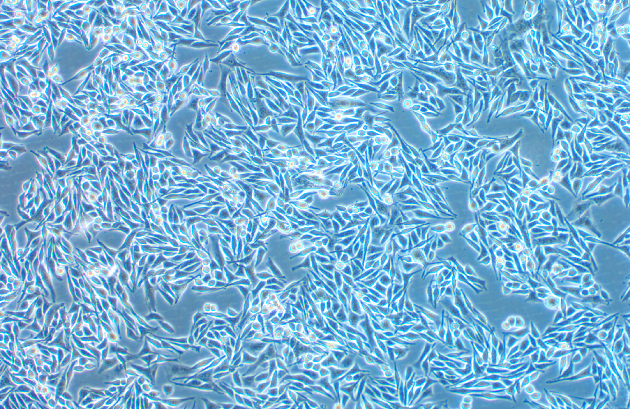 人脈絡(luò)膜黑色素瘤細(xì)胞MEL270(STR鑒定正確)
