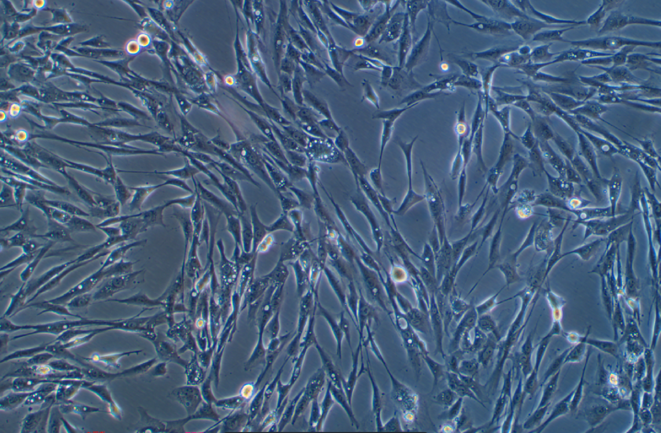 人主動脈平滑肌細胞永生化