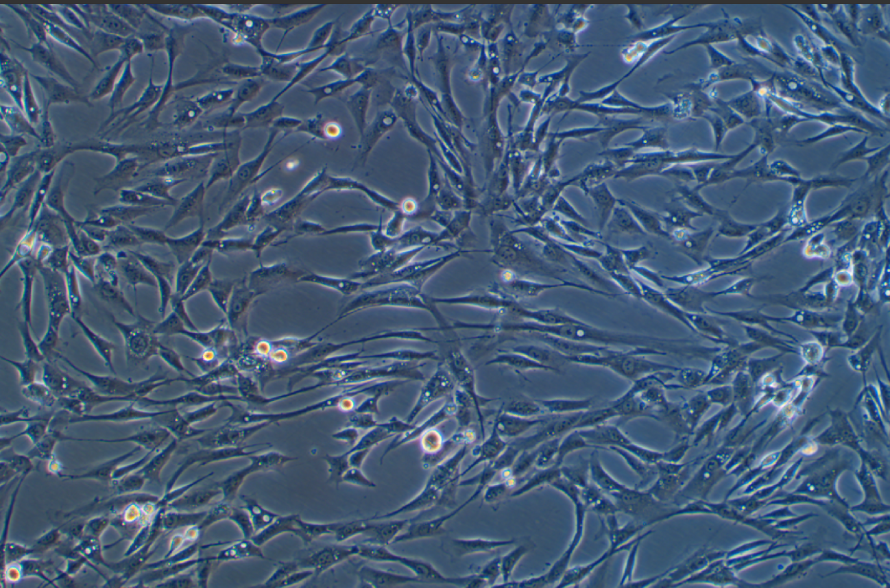 人主動脈平滑肌細胞永生化