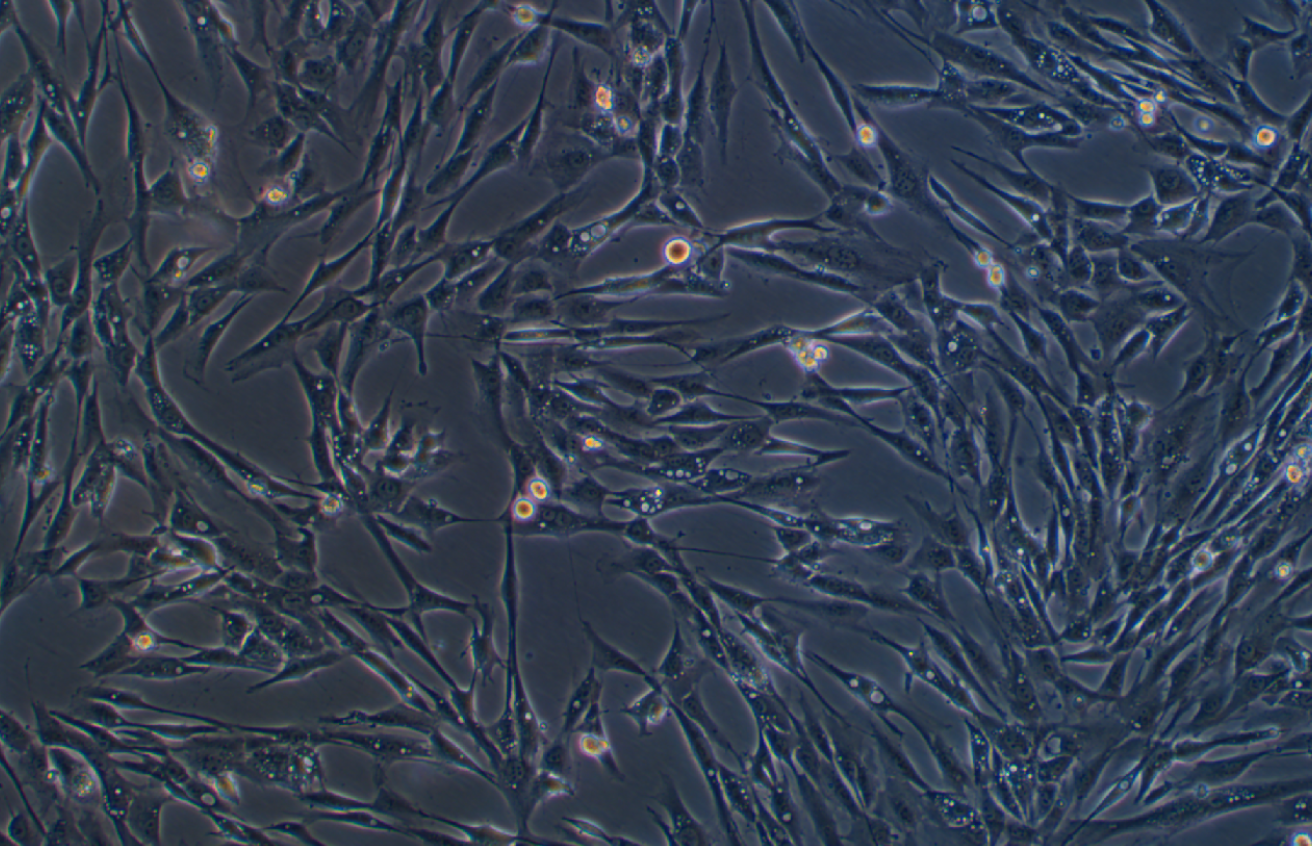 人主動脈平滑肌細胞永生化