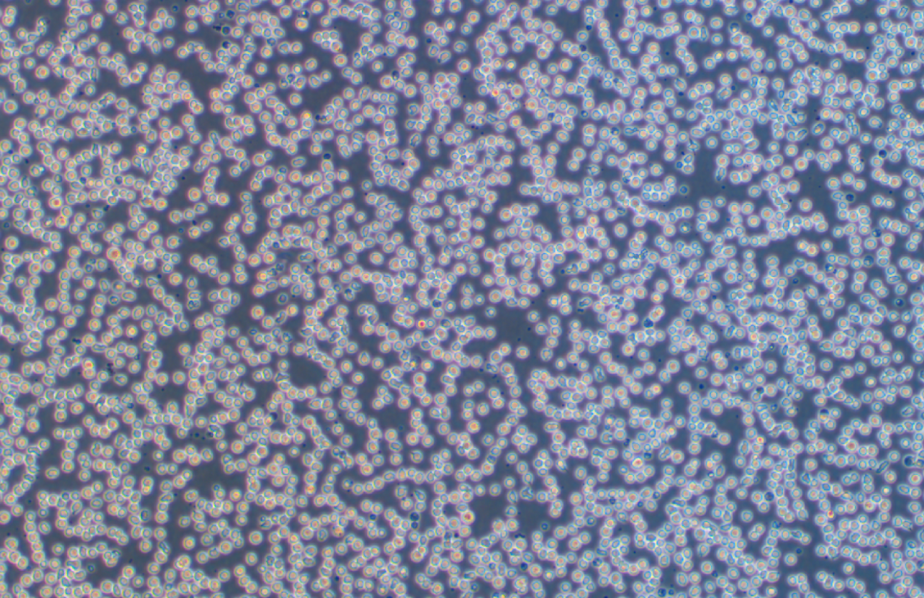 人急性淋巴白血病細胞RS4:11 (STR鑒定正確)
