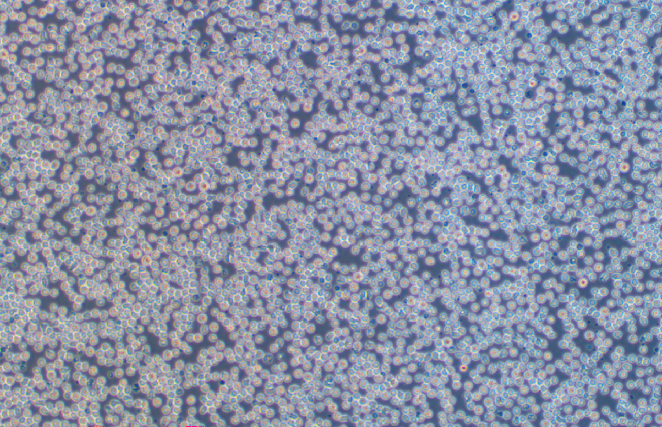 人急性淋巴白血病細胞RS4:11 (STR鑒定正確)