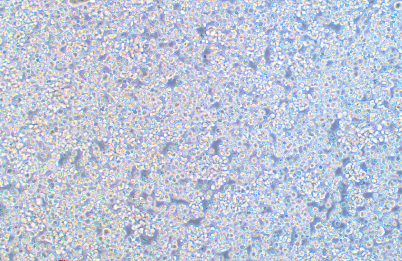 EB病毒感染的人外周淋巴細胞JVM-2(STR鑒定正確)