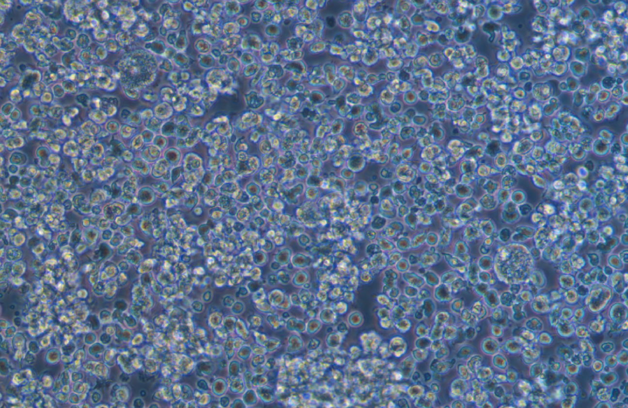 EB病毒感染的人外周淋巴細胞JVM-2(STR鑒定正確)