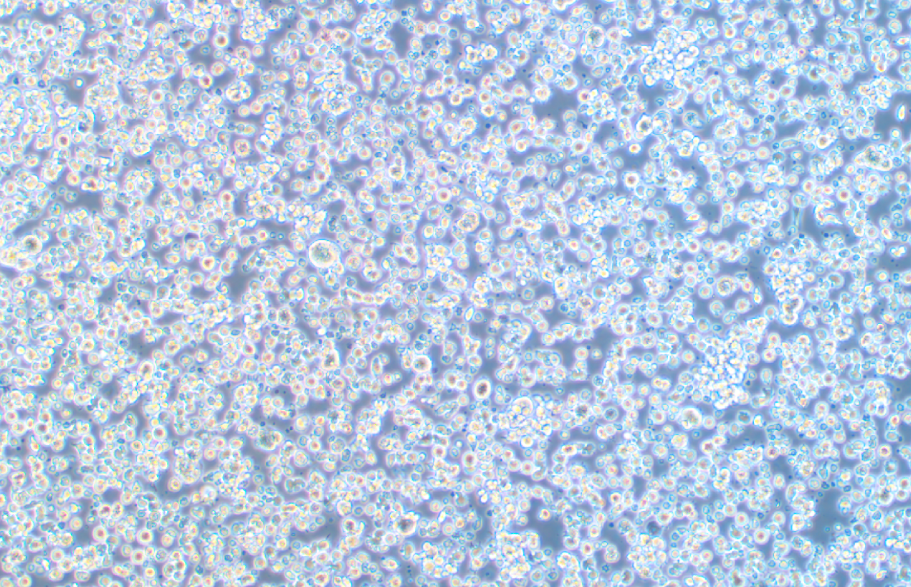 EB病毒感染的人外周淋巴細胞JVM-2(STR鑒定正確)